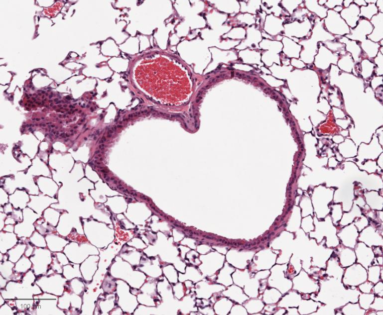 Pink and white blobs, forming a heart shape in the middle of the photo.