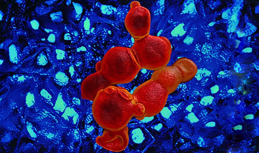 Red shapes against a blue background, with bright turquoise spots on the background.