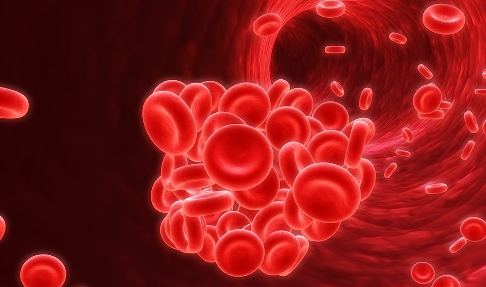 Blood Clot - Stock Image - C008/5083 - Science Photo Library