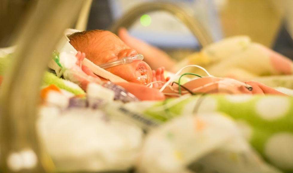 A premature baby in an incubator