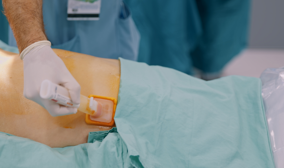 A person's abdomen being swabbed with iodine solution before surgery