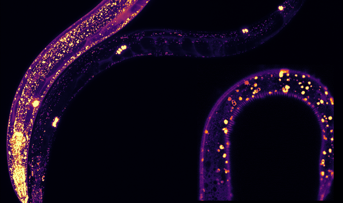 a slide of C. elegans worms with highlighted sections showing where the MANF proteins are present.