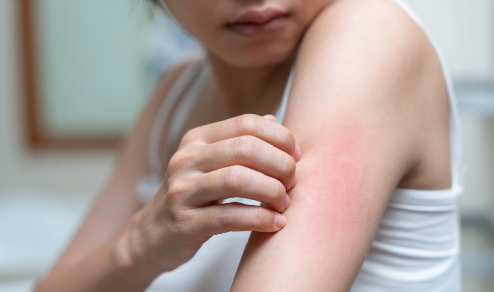 A person scratches their upper arm.