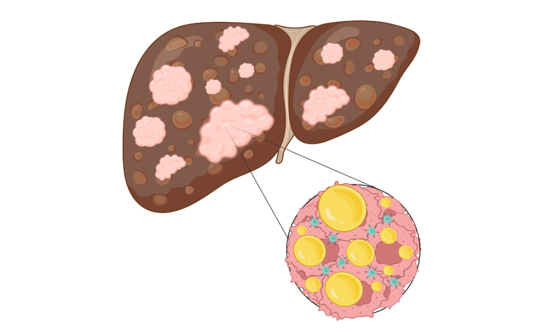An Illustration of a liver and the molecules inside it.