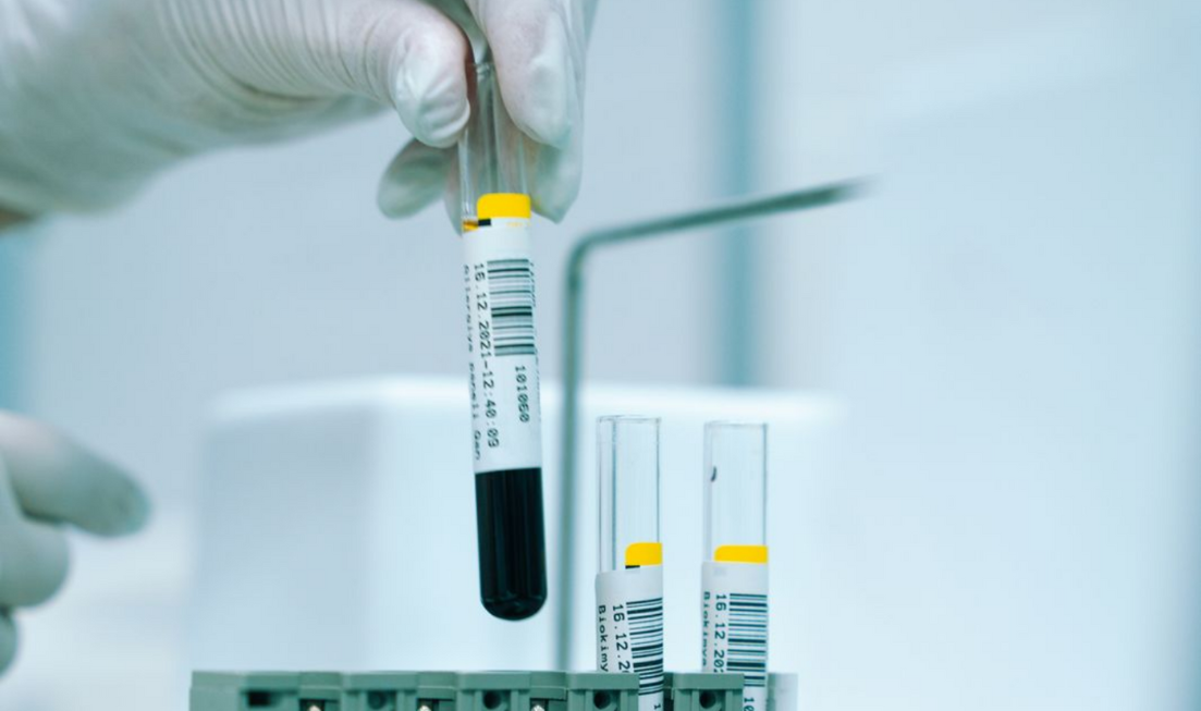 A gloved hand holds a medical vial of blood.